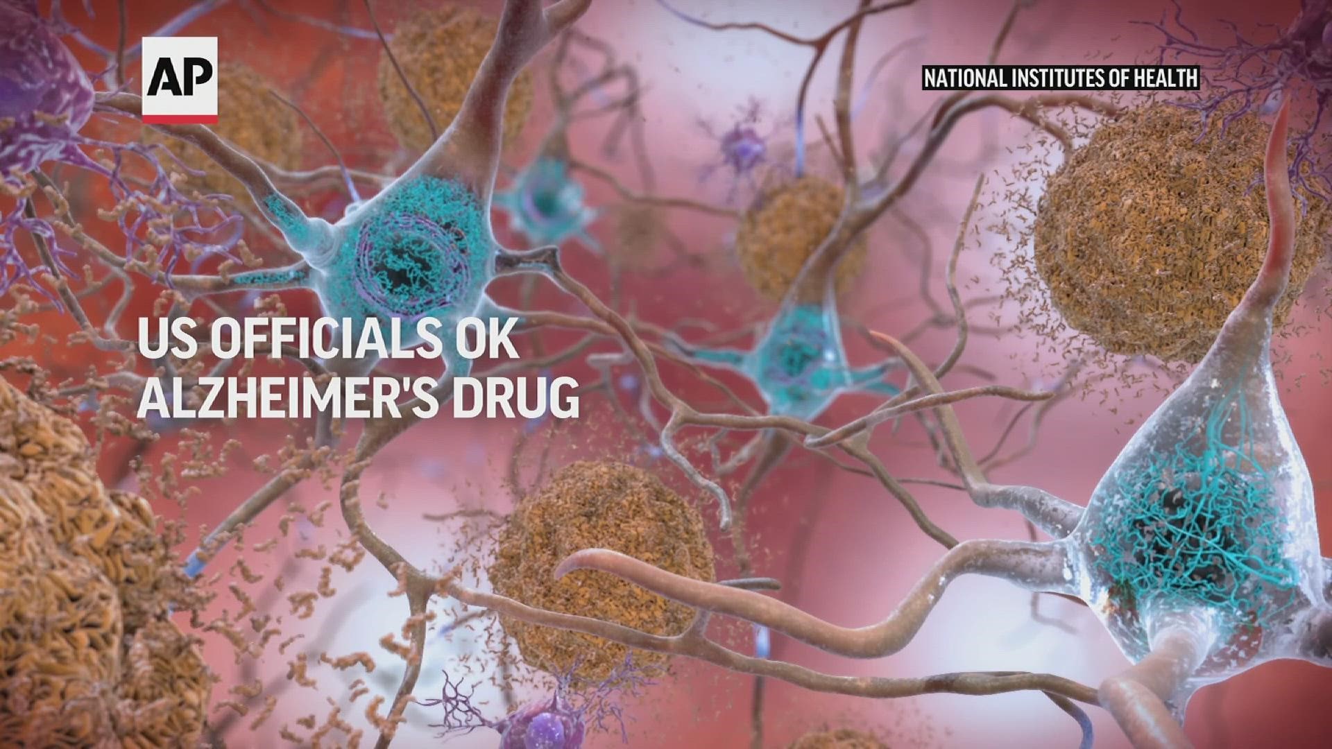 The drug is the first that's convincingly shown to slow the decline in memory and thinking that defines Alzheimer's by targeting the disease's underlying biology.