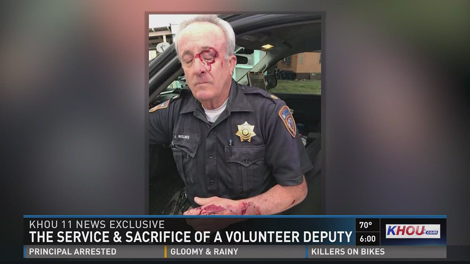 A graphic picture of an injured Harris County Sheriff's deputy has been shared more than 14,000 times on Facebook.