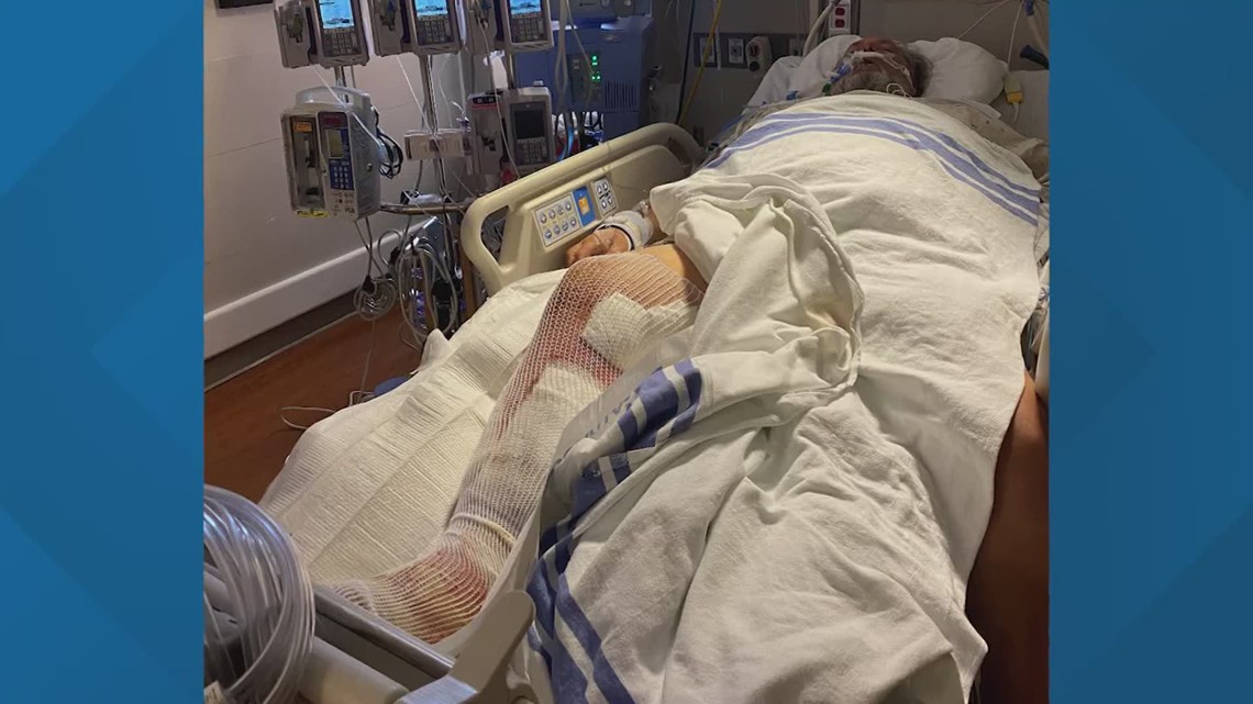 Oklahoma man nearly loses leg after contracting bacteria during family trip to Crystal Beach - Vimarsana News