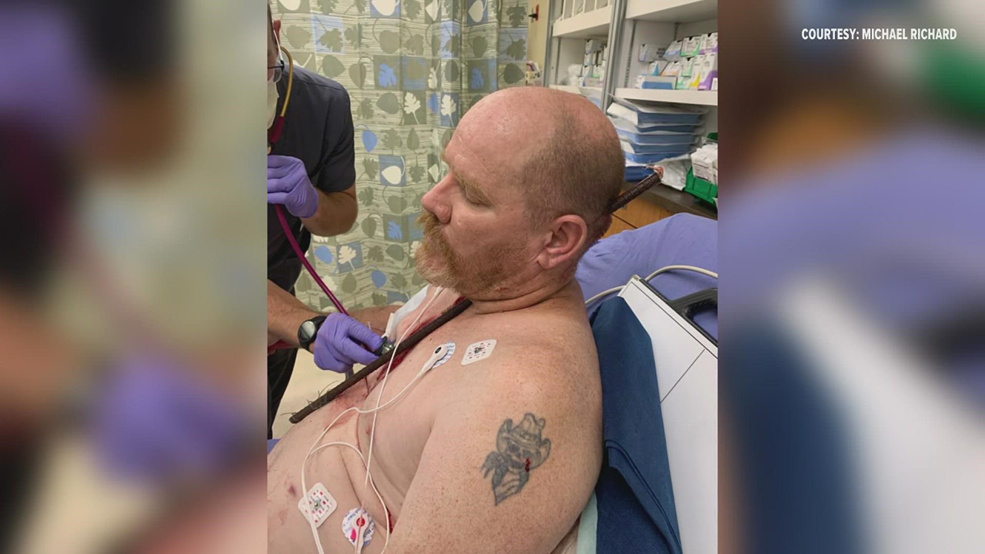 Graphic image warning Doctors say Nederland man is a walking miracle after falling on rebarb