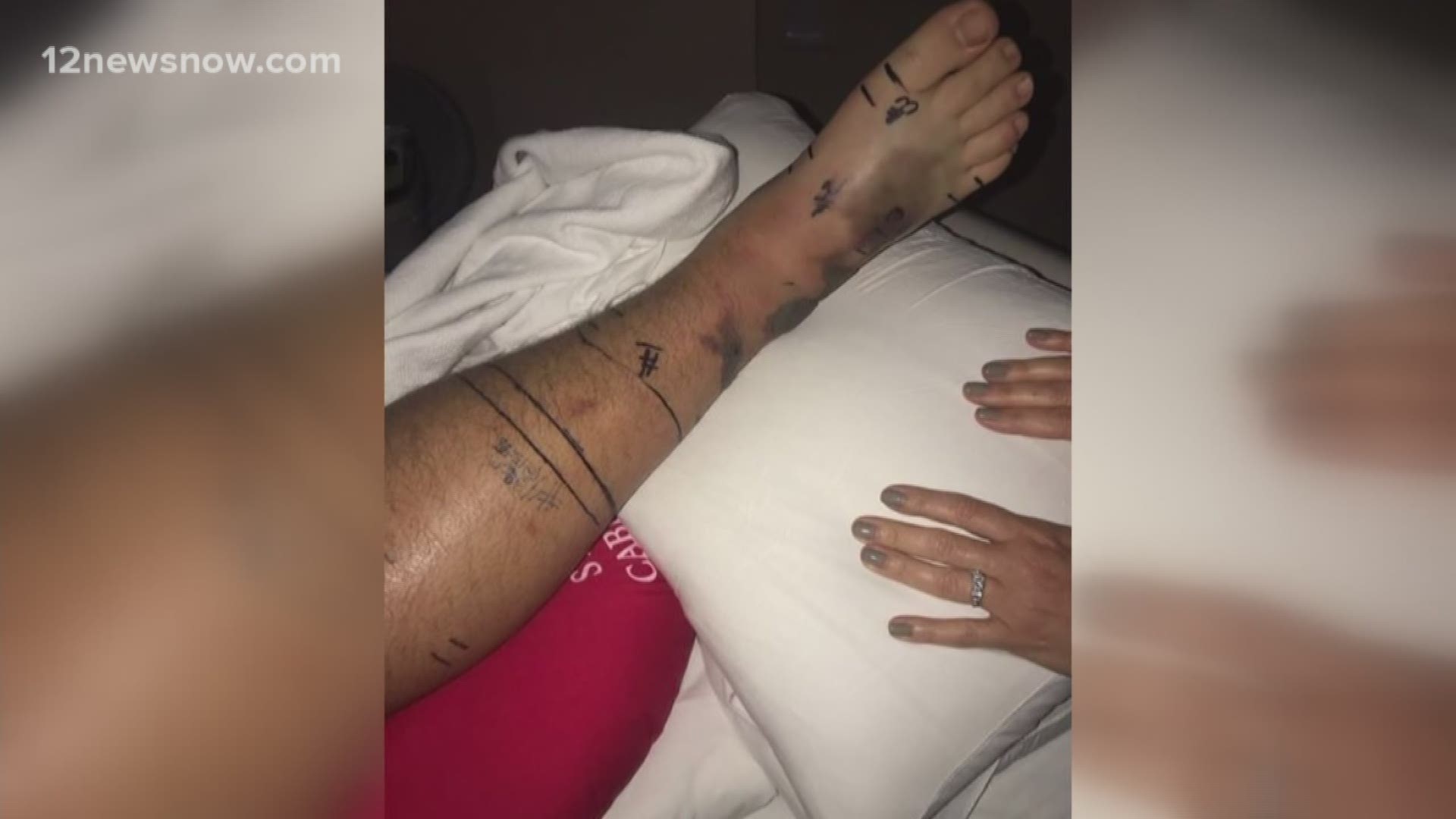 Snake bite leaves teen in the hospital