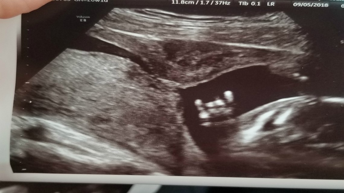 Aggie couple's baby throws up 'hook 'em' sign on ultrasound photo ...