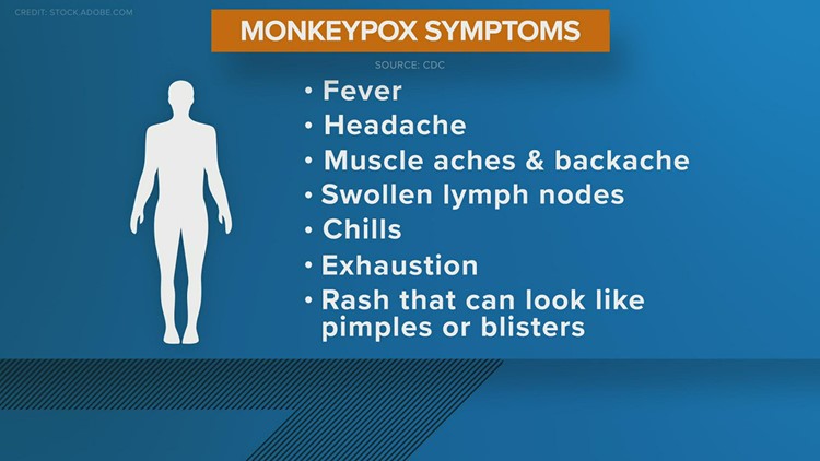 What are symptoms of the monkeypox virus?