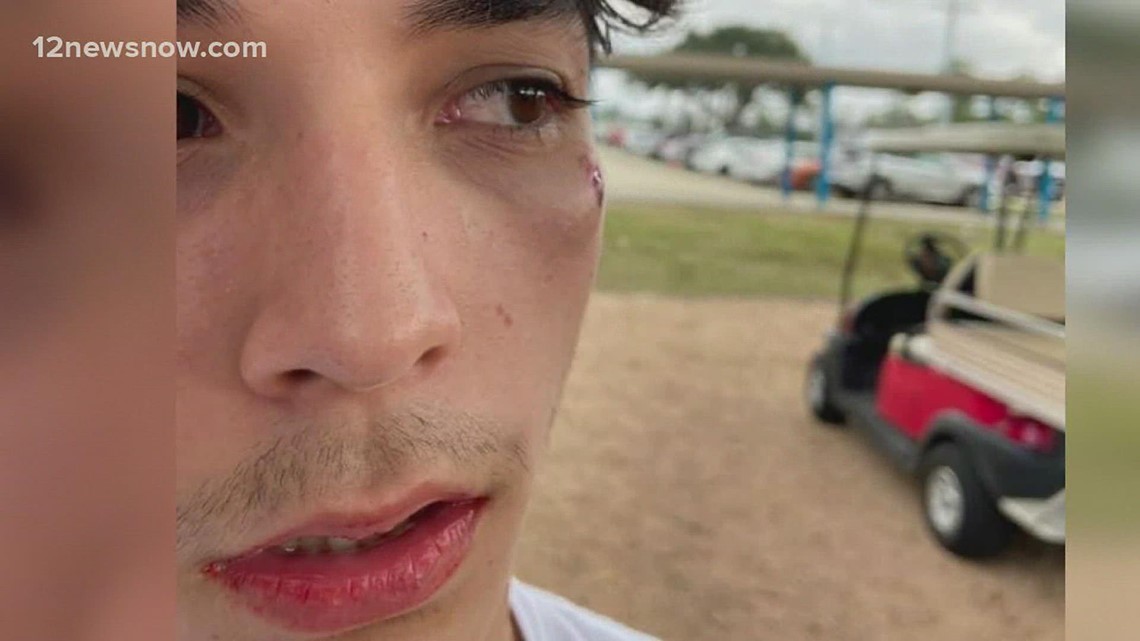 Parent fears for son's safety after fight at West Brook High School leaves him injured