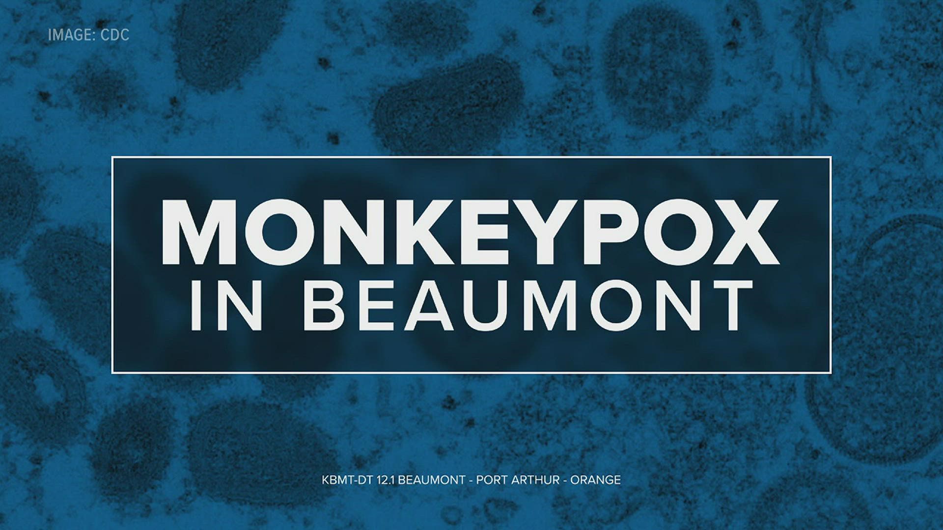 The City of Beaumont Public Health Department has announced the first case of Monkeypox documented in the city.