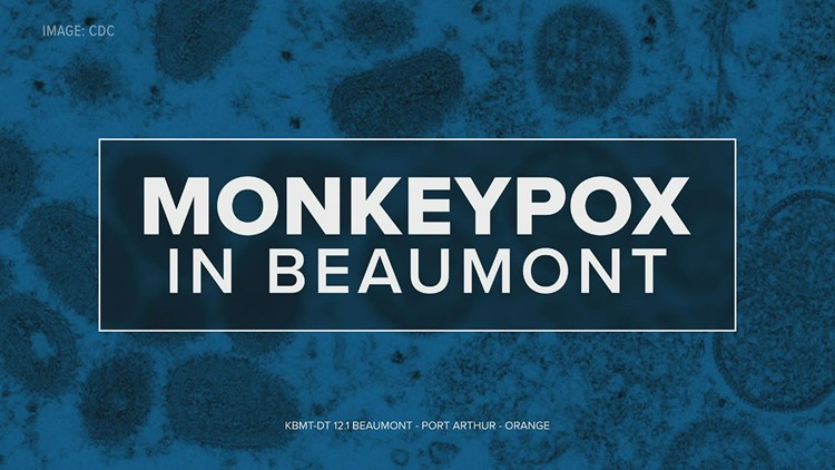 First case of monkeypox reported in Beaumont