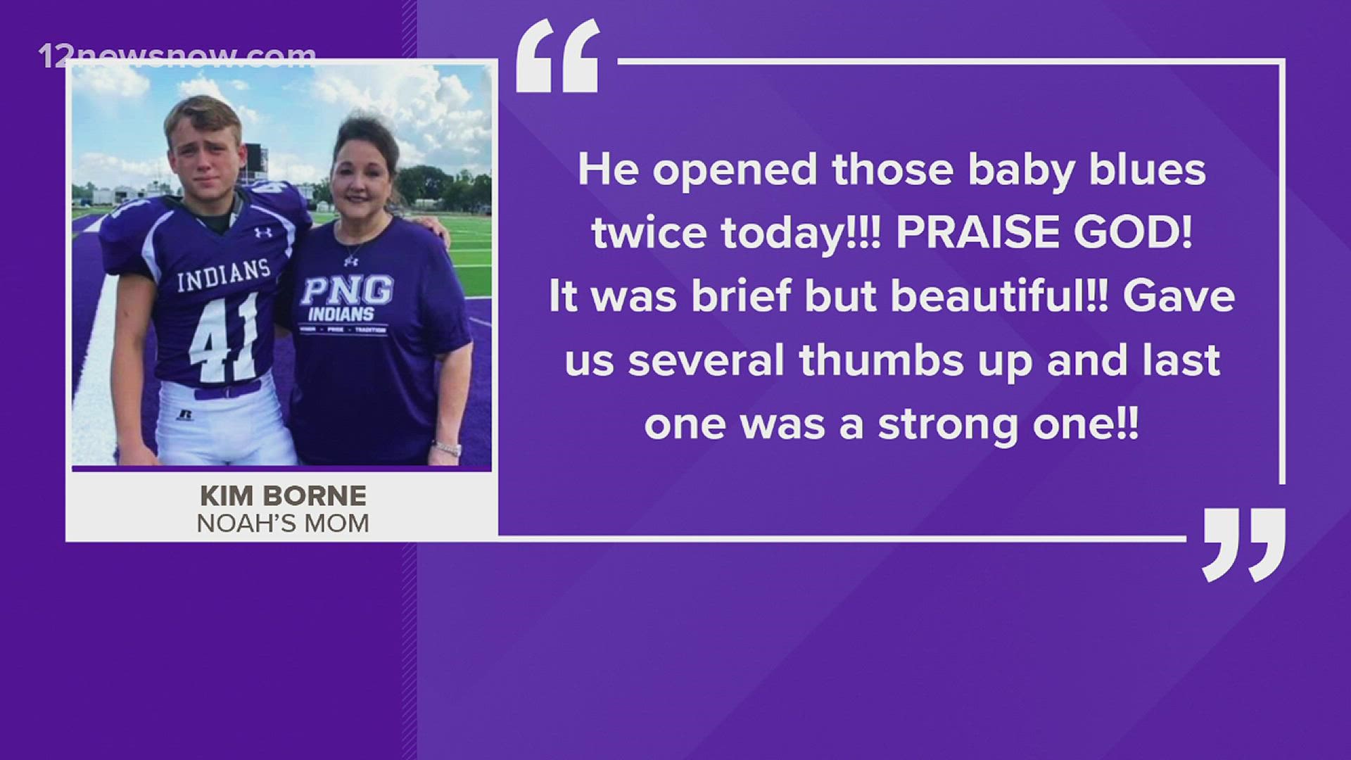 Noah Jackson has been in a medically induced coma at Texas Children's hospital.