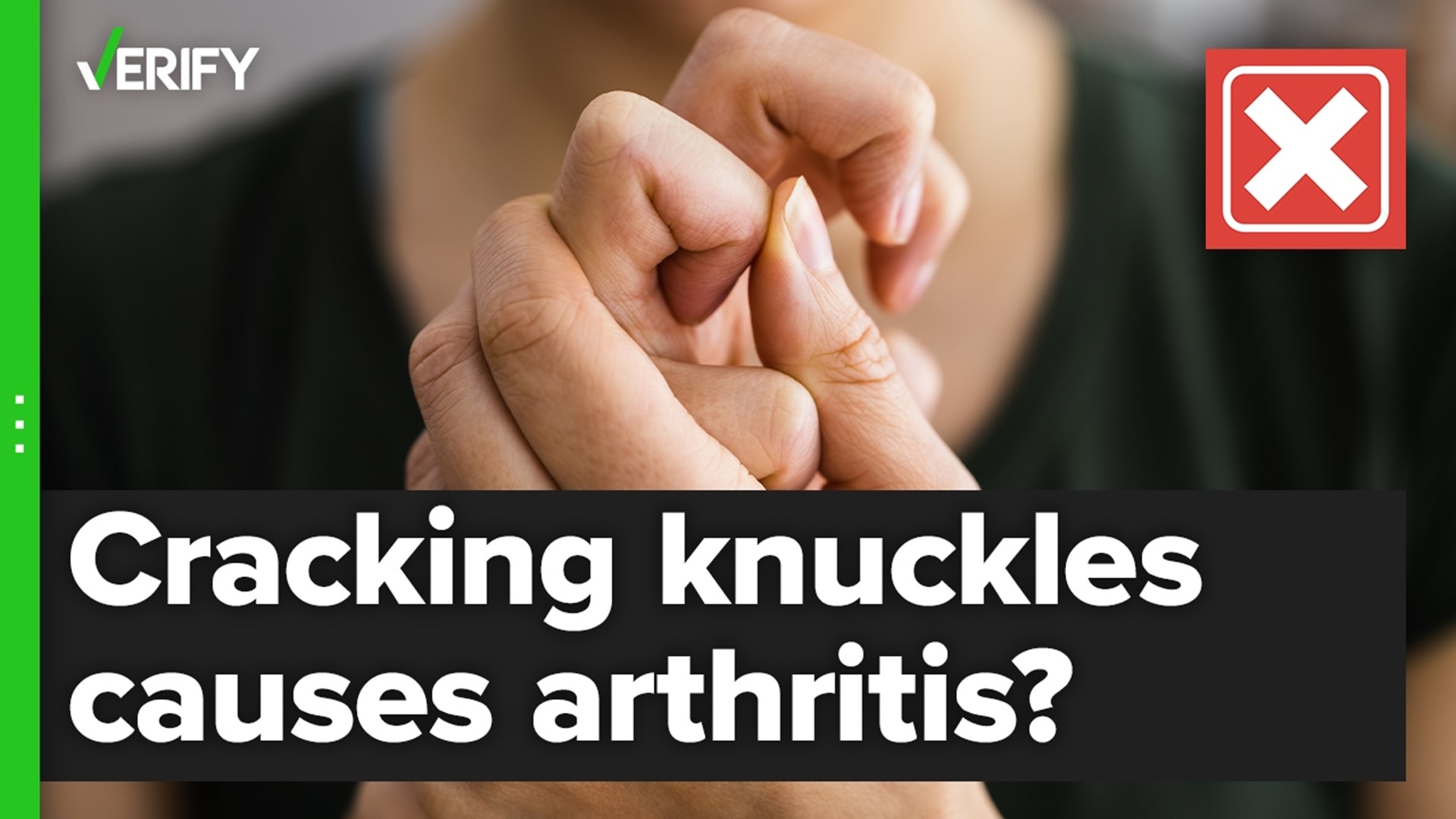 Popping your knuckles, if done correctly, has few if any long-term bad health effects, according to decades of studies. This includes osteoarthritis.