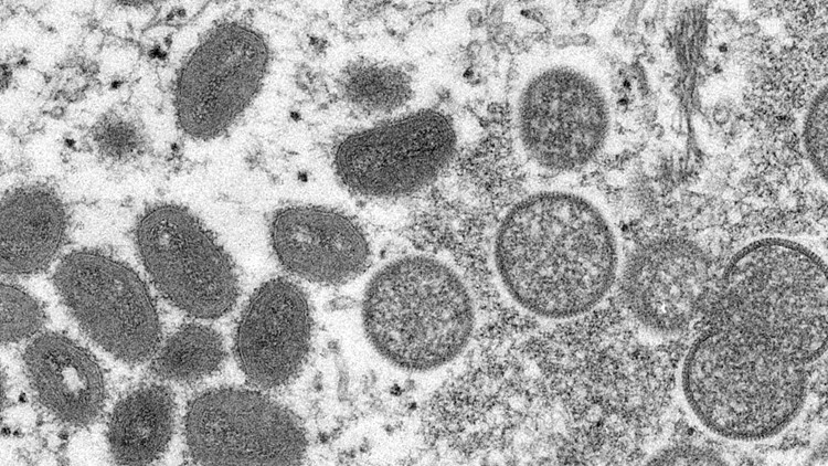 4 Fast Facts about monkeypox
